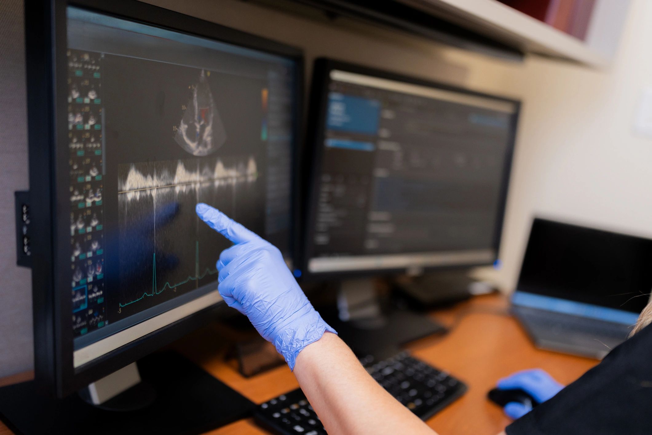 Tecnología médica utilizada para apoyar el diagnóstico
